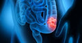 Bowel Regulator Formula